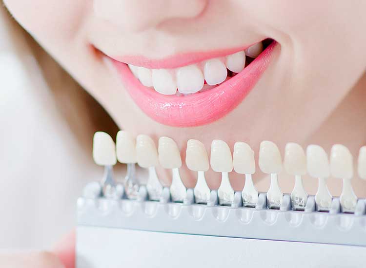 ホワイトニング